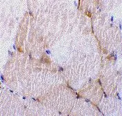 IHC-P analysis of rat skeletal muscle tissue using GTX42546 Caspase 7 antibody, N-term. IHC-P analysis of rat skeletal muscle tissue using GTX42546 Caspase 7 antibody, N-term.