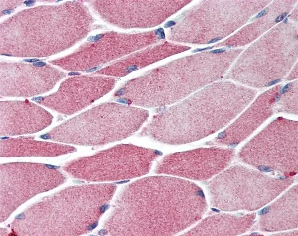 IHC-P analysis of skeletal muscle tissue using GTX42696 BACH1 antibody. IHC-P analysis of skeletal muscle tissue using GTX42696 BACH1 antibody.