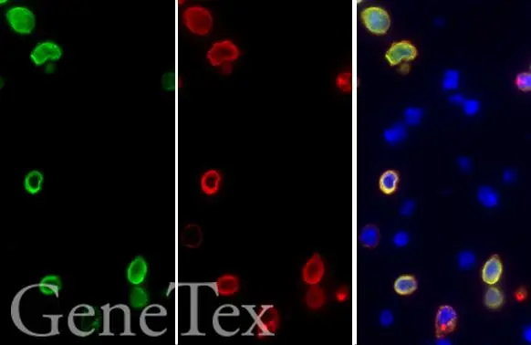 SARS-CoV-2 (COVID-19) spike antibody detects SARS-CoV-2 (COVID-19) spike (full length) protein by immunohistochemical analysis.</br>Sample: Paraffin-embedded SARS-CoV-2 (COVID-19) Spike FFPE Cell Pellet Block (GTX435640).</br>Green: SARS-CoV-2 (COVID-19) spike (full length) protein stained by SARS-CoV-2 (COVID-19) spike antibody (GTX135356) diluted at 1:1000.</br>Red: SARS-CoV-2 (COVID-19) spike (full length) protein stained by SARS-CoV / SARS-CoV-2 (COVID-19) spike antibody [1A9] (GTX632604) diluted at 1:1000.</br>Blue: Fluoroshield with DAPI (GTX30920).</br>Antigen Retrieval: Citrate buffer, pH 6.0, 15 min