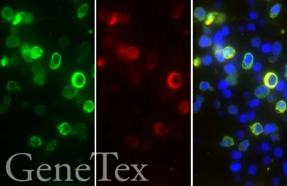 SARS-CoV-2 (COVID-19) nucleocapsid antibody detects SARS-CoV-2 (COVID-19) nucleocapsid protein by immunohistochemical analysis. Sample: Paraffin-embedded SARS-CoV-2 (COVID-19) Nucleocapsid FFPE Cell Pellet Block (GTX435641). Green: SARS-CoV-2 (COVID-19) nucleocapsid stained by SARS-CoV-2 (COVID-19) nucleocapsid antibody (GTX135357) diluted at 1:1000. Red: SARS-CoV / SARS-CoV-2 (COVID-19) nucleocapsid stained by SARS-CoV / SARS-CoV-2 (COVID-19) nucleocapsid antibody [6H3] (GTX632269) diluted at 1:1000. Blue: Fluoroshield with DAPI (GTX30920). Antigen Retrieval: Citrate buffer, pH 6.0, 15 min