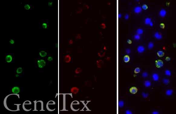 SARS-CoV-2 (COVID-19) spike antibody detects 6X His-tagged SARS-CoV-2 (COVID-19) spike (S1) protein by immunohistochemical analysis.