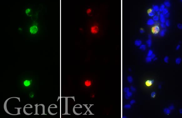 SARS-CoV / SARS-CoV-2 (COVID-19) spike antibody [1A9] detects 6X His-tagged SARS-CoV-2 (COVID-19) spike (S2) protein by immunohistochemical analysis.