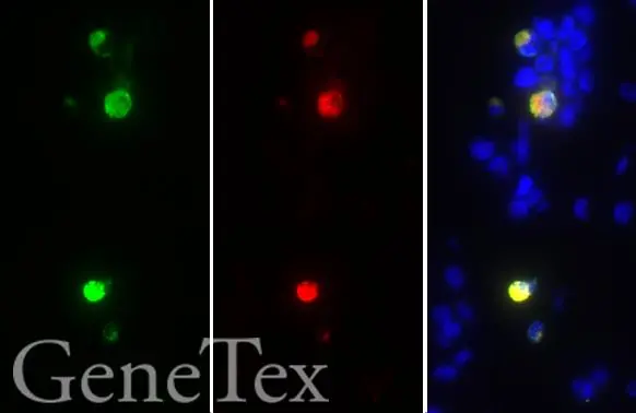 SARS-CoV / SARS-CoV-2 (COVID-19) spike antibody [1A9] detects 6X His-tagged SARS-CoV-2 (COVID-19) spike (S2) protein by immunohistochemical analysis. Sample: Paraffin-embedded SARS-CoV-2 (COVID-19) Spike (S2) FFPE Cell Pellet Block (GTX435644). Green: 6X His-tagged SARS-CoV-2 (COVID-19) spike (S2) protein stained by SARS-CoV / SARS-CoV-2 (COVID-19) spike antibody [1A9] (GTX632604) diluted at 1:1000. Red: 6X His-tagged SARS-CoV-2 (COVID-19) spike (S2) protein stained by 6X His tag antibody (GTX115045) diluted at 1:1000. Blue: Fluoroshield with DAPI (GTX30920). Antigen Retrieval: Citrate buffer, pH 6.0, 15 min