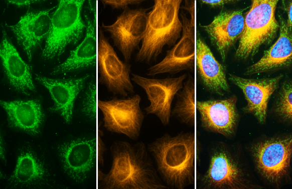 トップス L.G.B./PK/COATING FSD Fluor™ Triple-Color (488/594/647) Antibody Labeling Kit