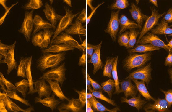 FSD Fluor™ Triple-Color (488/594/647) Antibody Labeling Kit