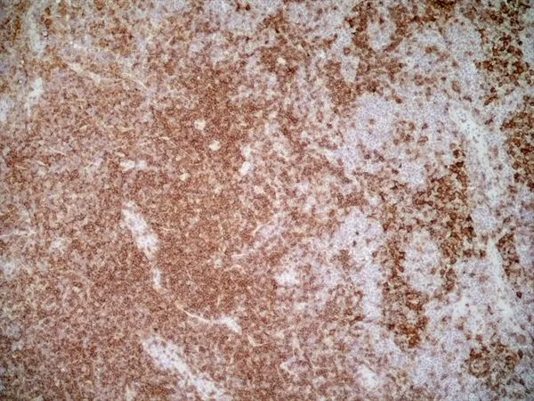 IHC-Fr analysis of rat lymph node tissue using GTX44519 CD4 (Domain 2) antibody [OX-35].