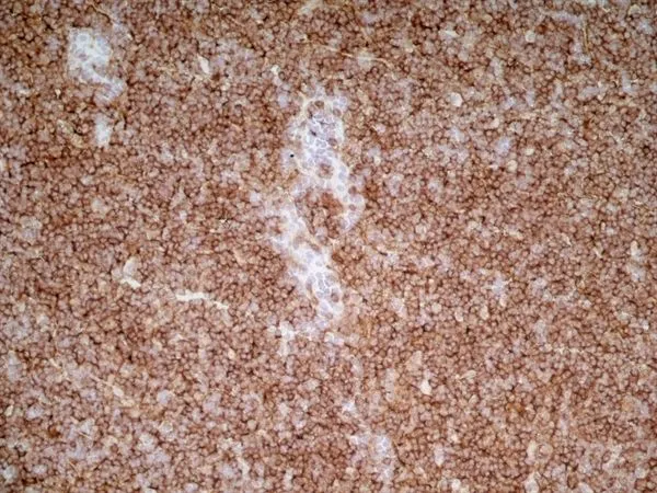 IHC-Fr analysis of rat lymph node tissue using GTX44519 CD4 (Domain 2) antibody [OX-35].