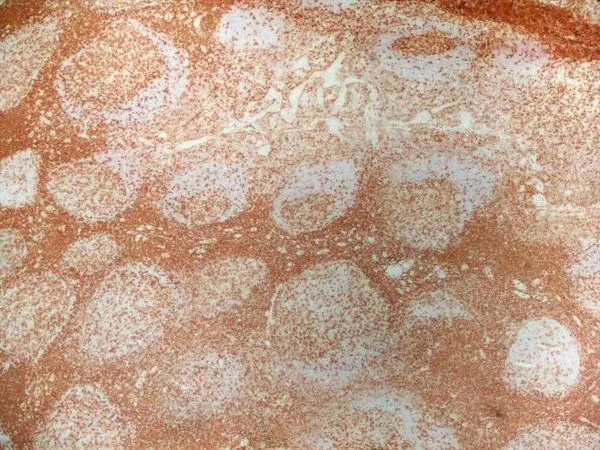 IHC-Fr analysis of human tonsil tissue using GTX44537 CD4 antibody [RPA-T4] (Low endotoxin, azide free).