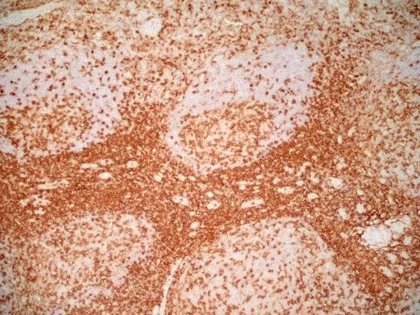 IHC-Fr analysis of human tonsil tissue using GTX44537 CD4 antibody [RPA-T4] (Low endotoxin, azide free).