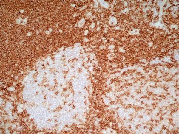 IHC-Fr analysis of human tonsil tissue using GTX44537 CD4 antibody [RPA-T4] (Low endotoxin, azide free).