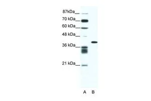 WB analysis of Jurkat cells using GTX44617 ALX4 antibody at 0.2-1microg/ml. Lane A : marker Lane B : Jurkat cells WB analysis of Jurkat cells using GTX44617 ALX4 antibody at 0.2-1microg/ml. Lane A : marker Lane B : Jurkat cells