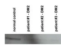 WB analysis of human primary myoblasts cells using GTX44628 CNBP antibody at 1:1000. Lane 1-4 : 1 : myoblasts cell lysate from normal control 2 : myoblasts cell lysate from myotonic dystrophy type 2 patients (DM2) 3 : myoblasts cell lysate from myotonic dystrophy type 2 patients (DM2) 4 : myoblasts cell lysate from myotonic dystrophy type 2 patients (DM2) WB analysis of human primary myoblasts cells using GTX44628 CNBP antibody at 1:1000. Lane 1-4 : 1 : myoblasts cell lysate from normal control 2 : myoblasts cell lysate from myotonic dystrophy type 2 patients (DM2) 3 : myoblasts cell lysate from myotonic dystrophy type 2 patients (DM2) 4 : myoblasts cell lysate from myotonic dystrophy type 2 patients (DM2)