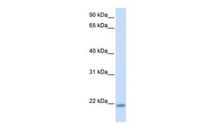 WB analysis of human fetal brain tissue using GTX44628 CNBP antibody at 0.2-1microg/ml.
