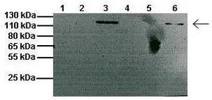 WB analysis of mouse muscle and brain tissue using GTX44629 CLCN1 antibody at 1:1000. Lanes: 1: 20microg mouse muscle membrane fraction 2: Empty 3: 20microg mouse brain membrane fraction 4: Empty 5: 20microg mouse muscle cytosolic fraction 6: 20microg mouse brain cytosolic fraction