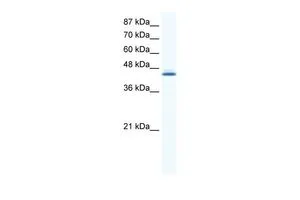 WB analysis of HepG2 cells using GTX44637 ALX4 antibody at 0.2-1microg/ml. WB analysis of HepG2 cells using GTX44637 ALX4 antibody at 0.2-1microg/ml.