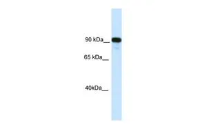 WB analysis of NIH-3T3 cells using GTX44642 CIITA antibody at 0.125microg/ml. WB analysis of NIH-3T3 cells using GTX44642 CIITA antibody at 0.125microg/ml.