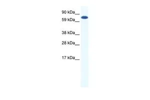 WB analysis of NIH-3T3 cells using GTX44661 CBFA2T2 antibody at 0.2-1microg/ml. WB analysis of NIH-3T3 cells using GTX44661 CBFA2T2 antibody at 0.2-1microg/ml.