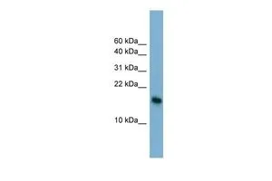 WB analysis of HT1080 cells using GTX44669 BATF3 antibody at 0.2-1microg/ml. WB analysis of HT1080 cells using GTX44669 BATF3 antibody at 0.2-1microg/ml.