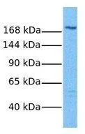 WB analysis of mouse thymus tissue using GTX44679 MRP2 antibody at 1.0microg/ml.