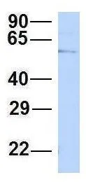 WB analysis of HepG2 cells using GTX44690 CHAF1B antibody at 1.0microg/ml. WB analysis of HepG2 cells using GTX44690 CHAF1B antibody at 1.0microg/ml.
