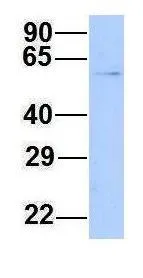 WB analysis of 293T cells using GTX44690 CHAF1B antibody at 1.0microg/ml. WB analysis of 293T cells using GTX44690 CHAF1B antibody at 1.0microg/ml.