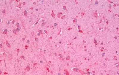 IHC-P analysis of human cortex tissue using GTX44806 GLP1R antibody. IHC-P analysis of human cortex tissue using GTX44806 GLP1R antibody.