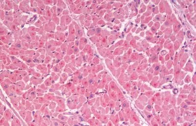 IHC-P analysis of human heart tissue using GTX44806 GLP1R antibody.