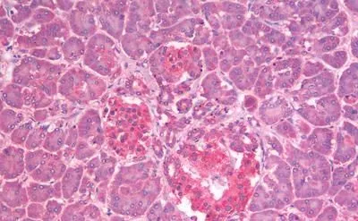 IHC-P analysis of human pancreas tissue using GTX44806 GLP1R antibody.