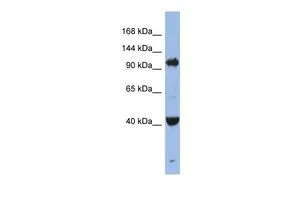 WB analysis of Jurkat cells using GTX44813 EIF2C4 antibody at 0.2-1microg/ml. WB analysis of Jurkat cells using GTX44813 EIF2C4 antibody at 0.2-1microg/ml.