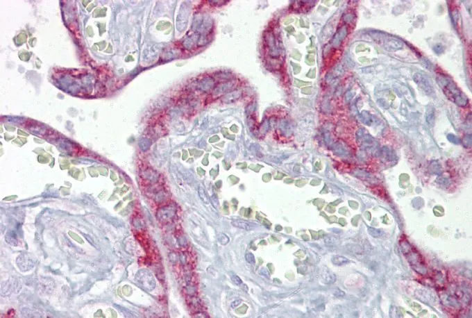 IHC-P analysis of human placenta tissue using GTX44824 TFAM antibody at 5microg/ml. IHC-P analysis of human placenta tissue using GTX44824 TFAM antibody at 5microg/ml.
