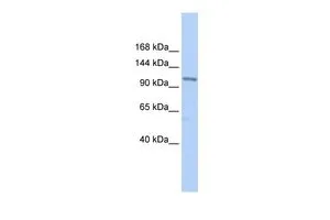 WB analysis of HepG2 cells using GTX44826 TRPC3 antibody at 0.2-1microg/ml. WB analysis of HepG2 cells using GTX44826 TRPC3 antibody at 0.2-1microg/ml.