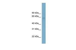 WB analysis of OVCAR-3 cells using GTX44848 LOC646951 antibody at 0.2-1microg/ml. WB analysis of OVCAR-3 cells using GTX44848 LOC646951 antibody at 0.2-1microg/ml.