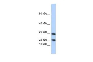 WB analysis of human B lymphoblast cells using GTX44849 LCN8 antibody at 0.2-1microg/ml. WB analysis of human B lymphoblast cells using GTX44849 LCN8 antibody at 0.2-1microg/ml.