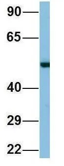 WB analysis of human fetal lung tissue using GTX44884 TINAGL1 antibody at 1microg/ml.