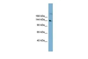 WB analysis of human fetal lung tissue using GTX44907 WDR35 antibody at 0.2-1microg/ml. WB analysis of human fetal lung tissue using GTX44907 WDR35 antibody at 0.2-1microg/ml.