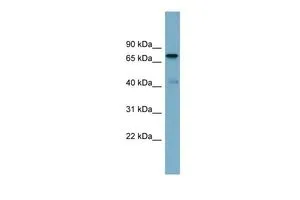 WB analysis of human fetal liver tissue using GTX44938 LRDD antibody at 0.2-1microg/ml. WB analysis of human fetal liver tissue using GTX44938 LRDD antibody at 0.2-1microg/ml.