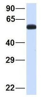 WB analysis of human placenta tissue using GTX44945 SPATA7 antibody at 1microg/ml.