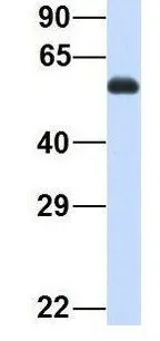 WB analysis of human fetal heart tissue using GTX44945 SPATA7 antibody at 1microg/ml.