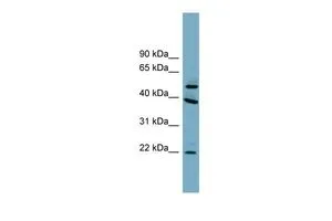 WB analysis of human fetal brain tissue using GTX44950 C4ORF20 antibody at 0.2-1microg/ml. WB analysis of human fetal brain tissue using GTX44950 C4ORF20 antibody at 0.2-1microg/ml.