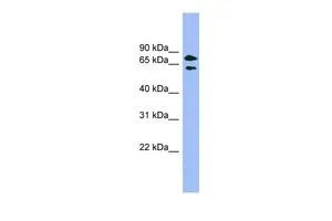 WB analysis of HepG2 cells using GTX44962 PANK4 antibody at 0.2-1microg/ml. WB analysis of HepG2 cells using GTX44962 PANK4 antibody at 0.2-1microg/ml.