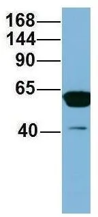WB analysis of human fetal heart tissue using GTX44971 C17ORF71 antibody at 1microg/ml.