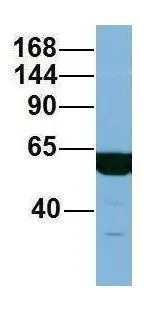 WB analysis of human fetal liver tissue using GTX44971 C17ORF71 antibody at 1microg/ml.