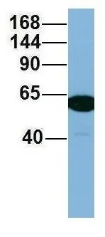WB analysis of human fetal lung tissue using GTX44971 C17ORF71 antibody at 1microg/ml.