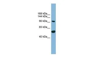 WB analysis of 293T cells using GTX44977 MAP7D1 antibody at 0.2-1microg/ml. WB analysis of 293T cells using GTX44977 MAP7D1 antibody at 0.2-1microg/ml.