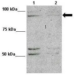 WB analysis of L929 cells using GTX44977 MAP7D1 antibody at 1:1000. Loading amount: 10ug. Lane 1: L929 cells Lane 2: L929 cells + MAP7D1 siRNA