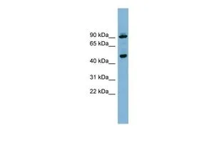 WB analysis of 293T cells using GTX44982 WIPI1 antibody at 0.2-1microg/ml. WB analysis of 293T cells using GTX44982 WIPI1 antibody at 0.2-1microg/ml.