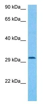 WB analysis of human colon tumor tissue using GTX45033 PRR5 antibody at 1microg/ml. WB analysis of human colon tumor tissue using GTX45033 PRR5 antibody at 1microg/ml.