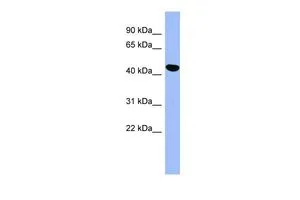 WB analysis of HepG2 cells using GTX45043 SERPINE2 antibody at 0.2-1microg/ml. WB analysis of HepG2 cells using GTX45043 SERPINE2 antibody at 0.2-1microg/ml.