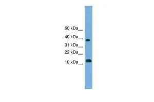 WB analysis of THP-1 cells using GTX45120 LOC152586 antibody at 0.2-1microg/ml. WB analysis of THP-1 cells using GTX45120 LOC152586 antibody at 0.2-1microg/ml.