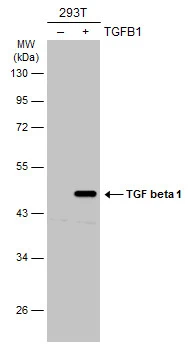 Non-transfected (�) and transfected (+) 293T whole cell extracts (30 ug) were separated by 10% SDS-PAGE,and the membrane was blotted with TGF beta 1 antibody (GTX45121) diluted at 1:5000.